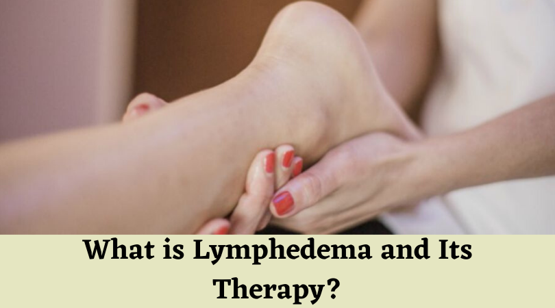 What is Lymphedema and Its Therapy_